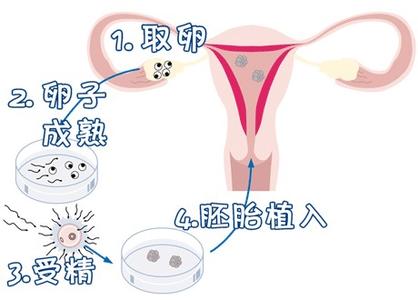 中心环境